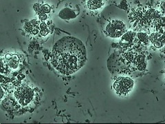 顕微鏡による細菌像
