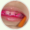 3.カチッと咬んだ状態でお口を閉じぎみにして、奥歯のほっぺた側を磨きましょう