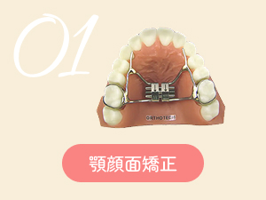 顎顔面矯正