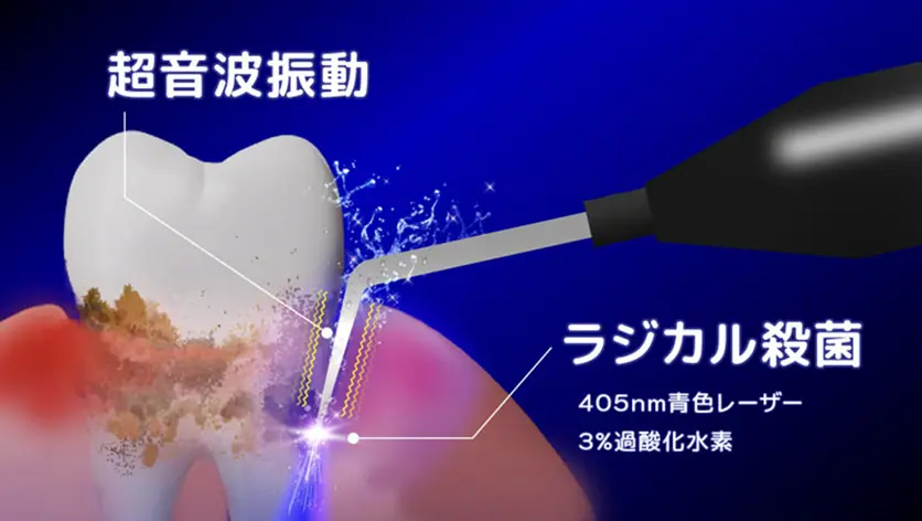 ブルーラジカルの超音波振動・ラジカル殺菌