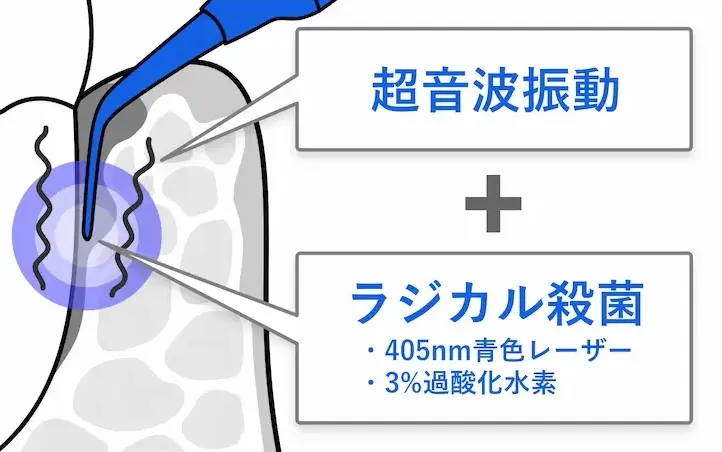 超音波振動＋ラジカル殺菌