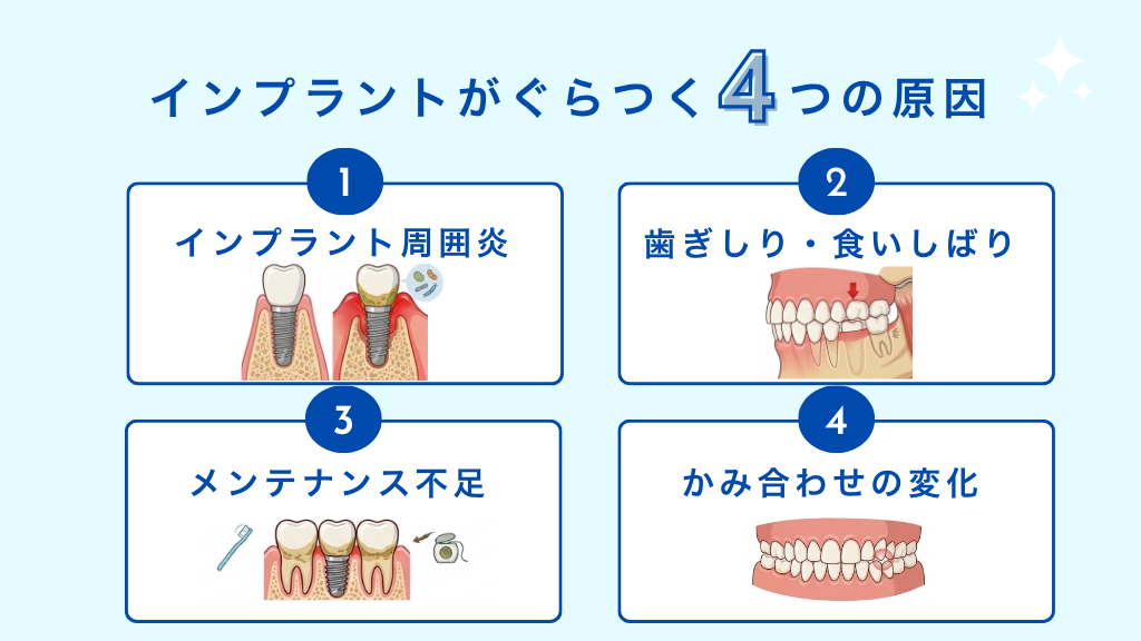 インプラントがぐらつく原因を示した図解