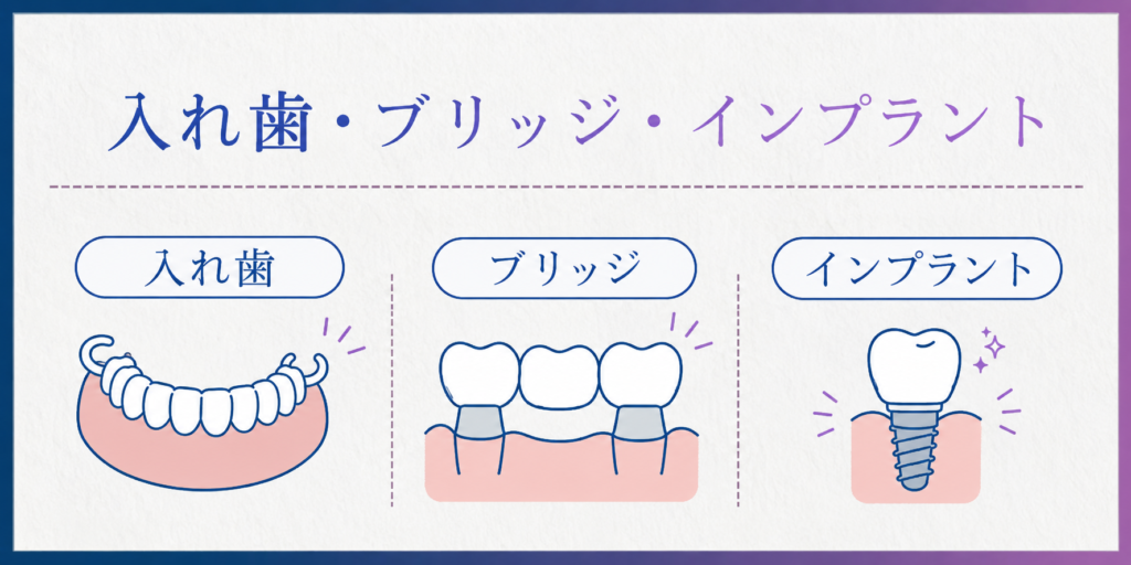 入れ歯・ブリッジ・インプラントを比較する図解