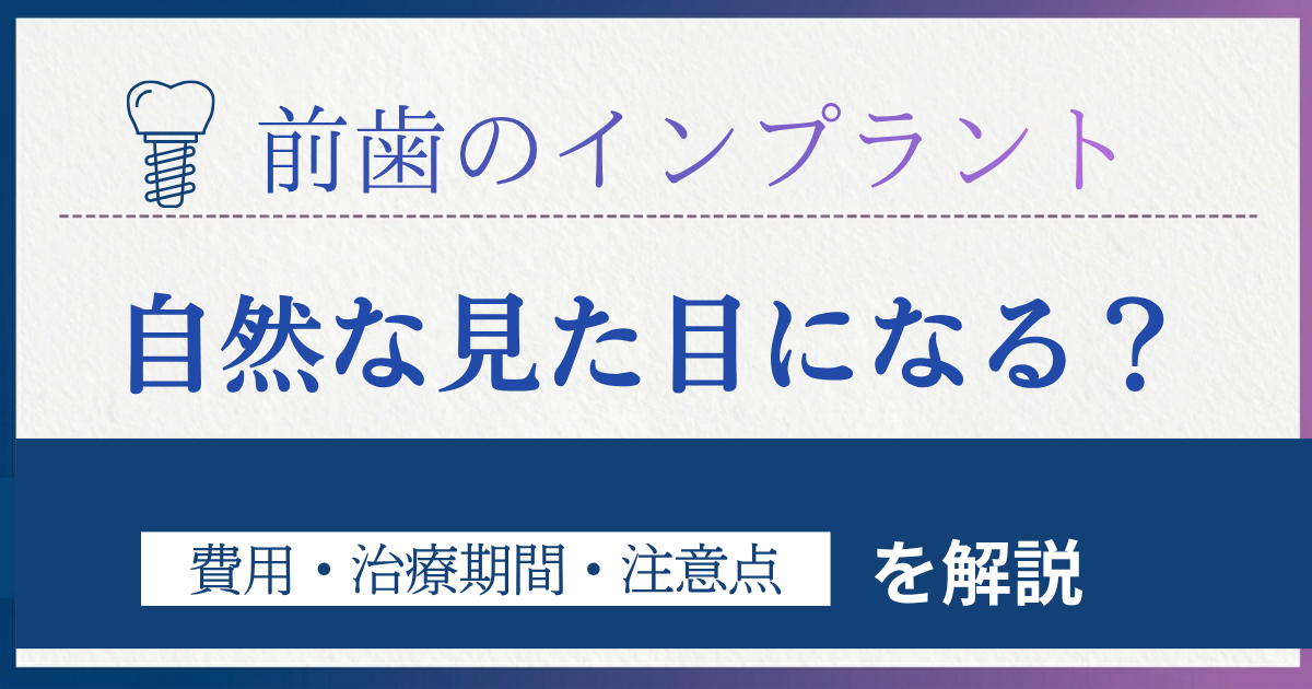 前歯のインプラントに関する記事のアイキャッチ画像