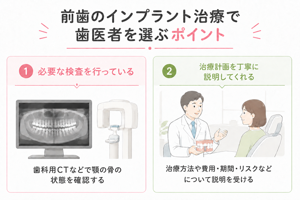 前歯のインプラント治療で歯医者を選ぶポイントに関する図解